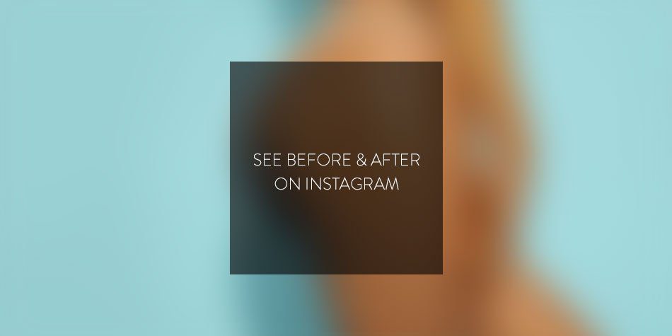 See before & after on Instagram